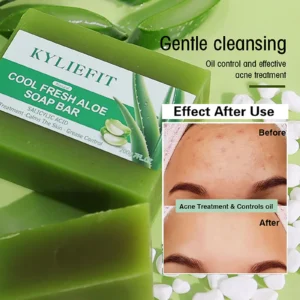 Aloe Vera Whitening Soap, Remove Acne, Bath Wash for All Skin Types